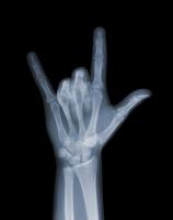 Rock On by Nick Veasey